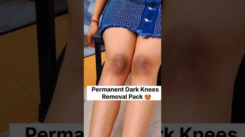 Maxresdefault 22 796x445