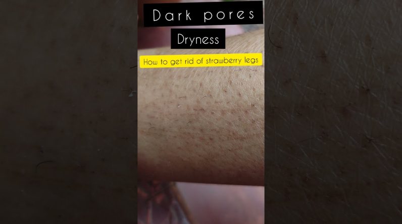 Maxresdefault 15 796x445